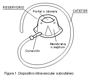 Figura 1. Dispositivo intravascular subcutáneo