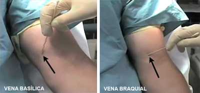 https://servpub.madrid.es/manualsamur/images/60402b_08.jpg
