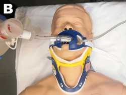 Intubación B