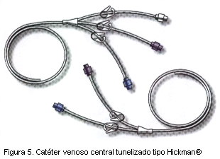 Figura 5. Catéter venoso central tipo Hickman®