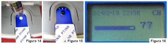Figuras 14 a 16