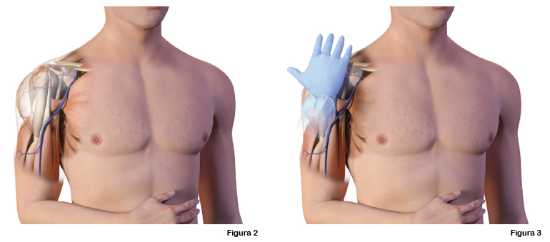Figuras 2 y 3