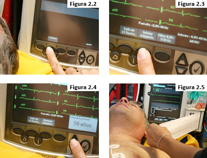 Figuras 2.2 - 2.5: Pasos para realizar EKG 12