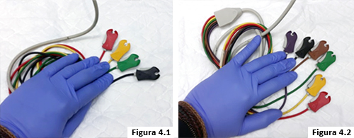 Figuras 4.1 y 4.2: Cable de EKG de 4 y 6 derivaciones