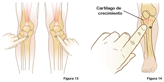 Figuras 13 y 14